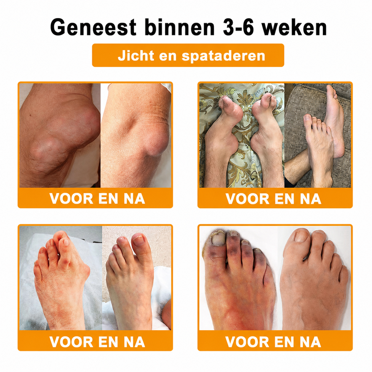 🔥 Laatste kans! Profiteer nu van deze geweldige aanbieding met 90% KORTING!  🎁 180 dagen niet-goed-geld-terug-garantie ✈️ Gratis verzending via luchtpost  Natravor®