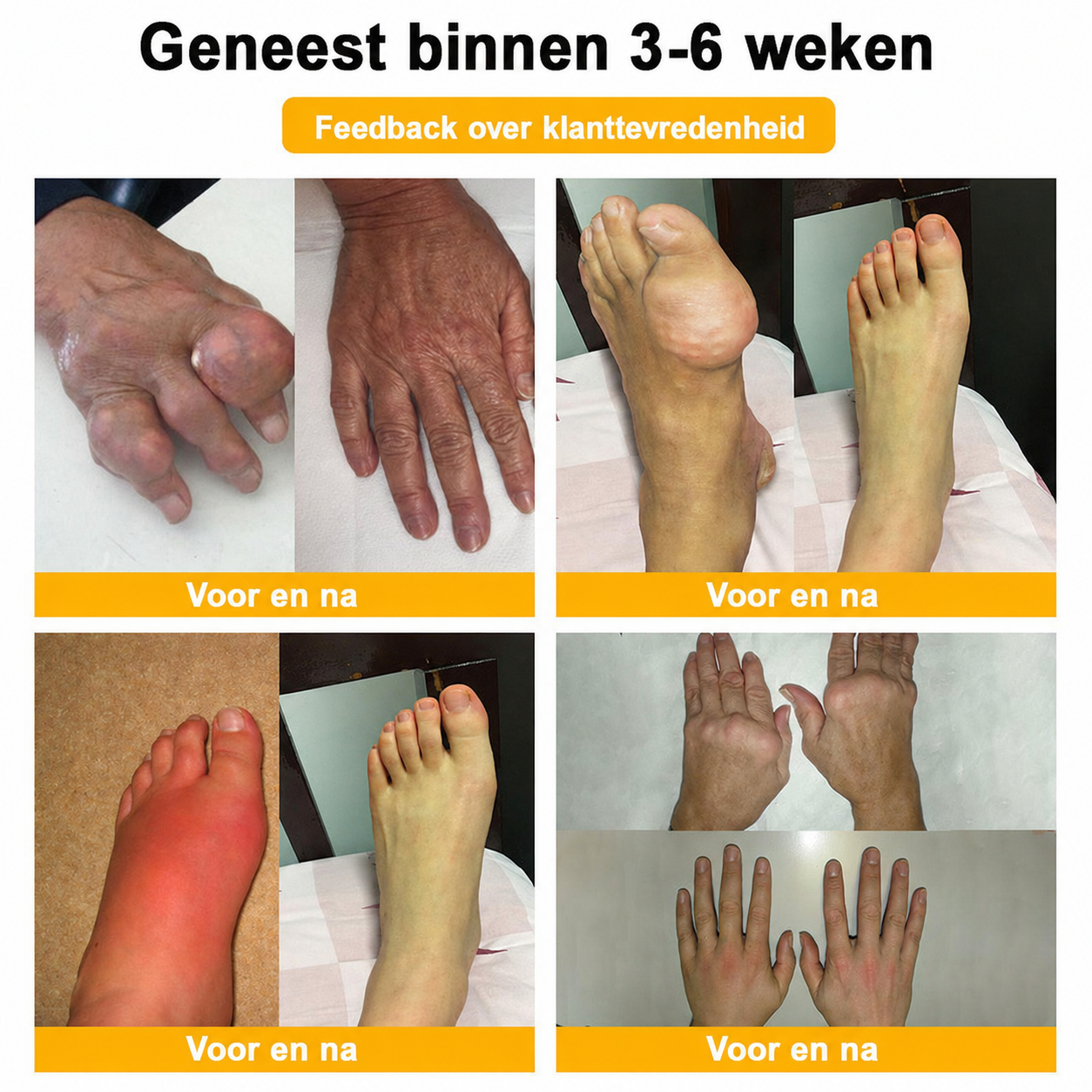 🔥 Laatste kans! Profiteer nu van deze geweldige aanbieding met 90% KORTING!  🎁 180 dagen niet-goed-geld-terug-garantie ✈️ Gratis verzending via luchtpost  Natravor®