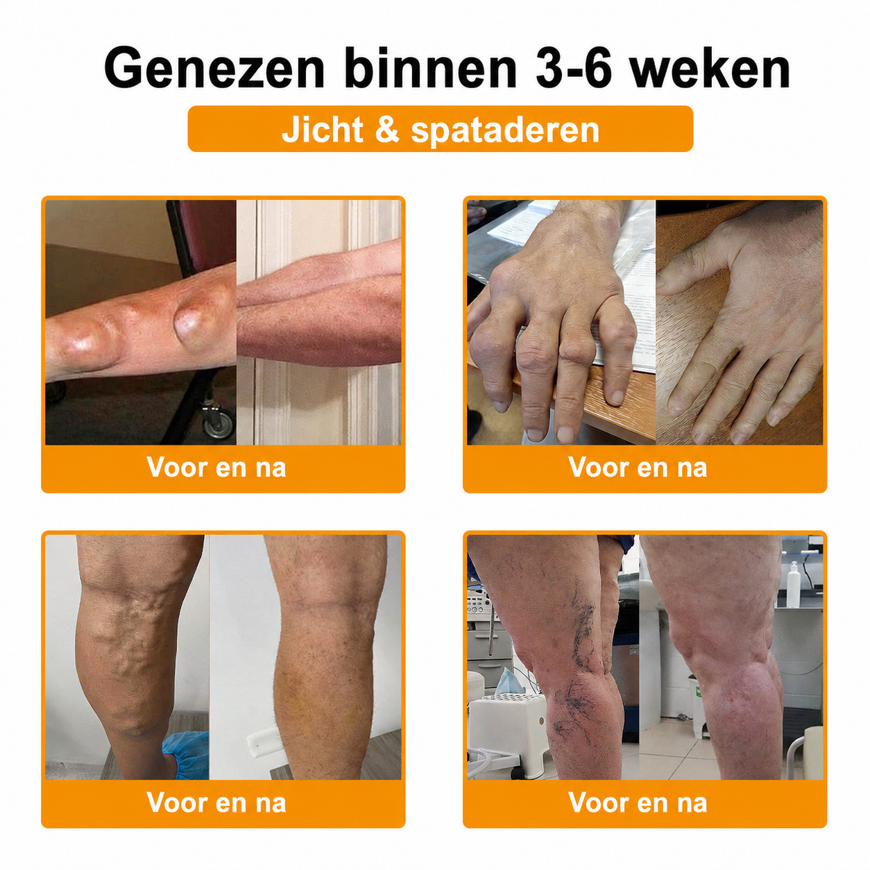 🔥 Laatste kans! Profiteer nu van deze geweldige aanbieding met 90% KORTING!  🎁 180 dagen niet-goed-geld-terug-garantie ✈️ Gratis verzending via luchtpost  Natravor®