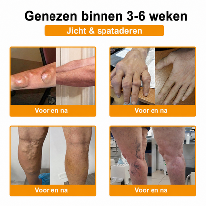 🔥 Laatste kans! Profiteer nu van deze geweldige aanbieding met 90% KORTING!  🎁 180 dagen niet-goed-geld-terug-garantie ✈️ Gratis verzending via luchtpost  Natravor®