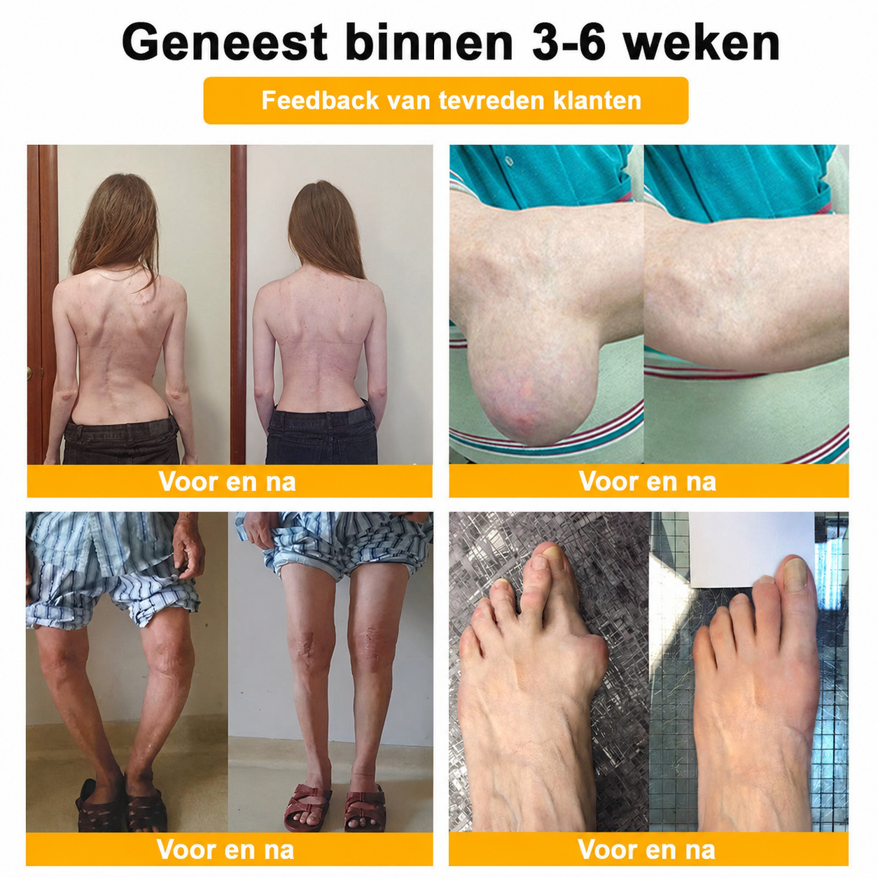 🔥 Laatste kans! Profiteer nu van deze geweldige aanbieding met 90% KORTING!  🎁 180 dagen niet-goed-geld-terug-garantie ✈️ Gratis verzending via luchtpost  Natravor®