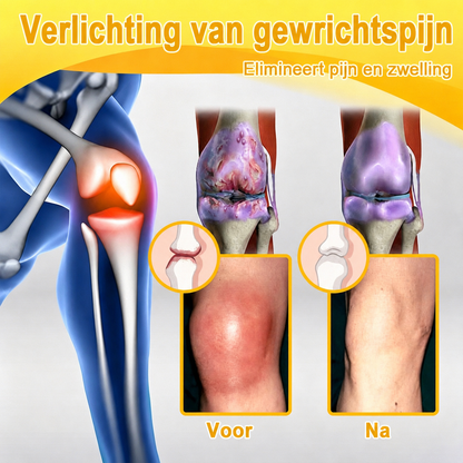 🔥 Laatste kans! Profiteer nu van deze geweldige aanbieding met 90% KORTING!  🎁 180 dagen niet-goed-geld-terug-garantie ✈️ Gratis verzending via luchtpost  Natravor®